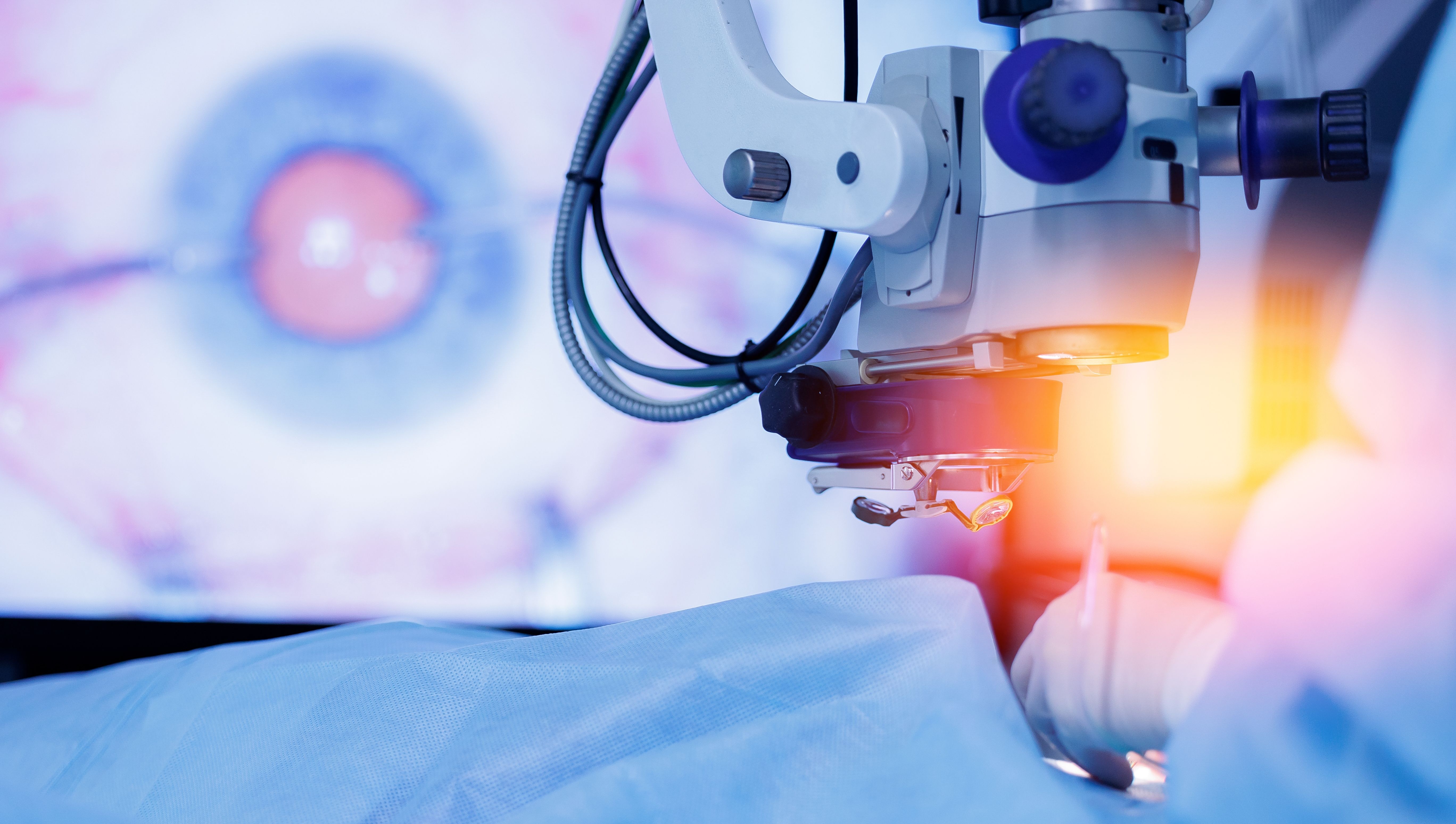 laser-vision correction-review.jpg